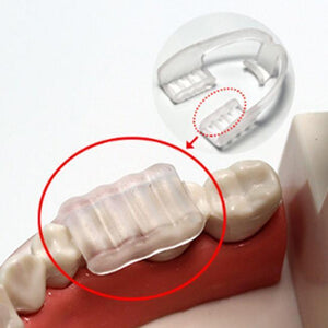 Aufbissschiene von Xceldent - gegen Zähneknirschen